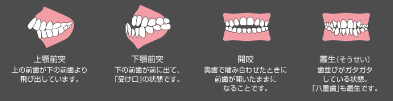 orthodontic_02