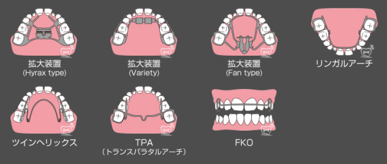 orthodontic_03
